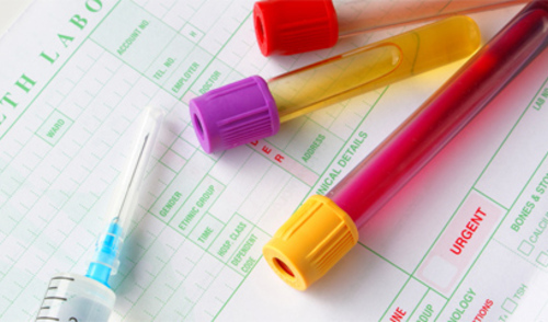 Komorbiditeti kod bolesnika s ponavljajućim depresivnim poremećajem Komorbiditeti kod bolesnika s ponavljajućim depresivnim poremećajem